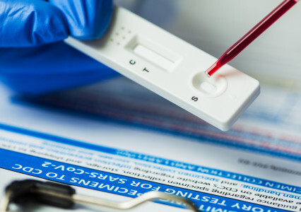 IMMUNOCHROMATOGRAPHIC ASSAYS